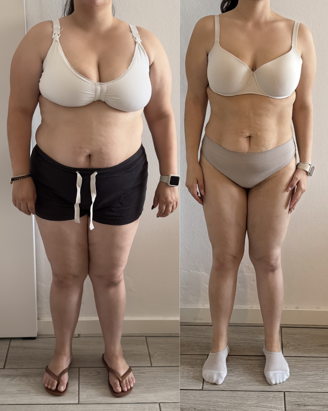 Antes e depois de cliente 5